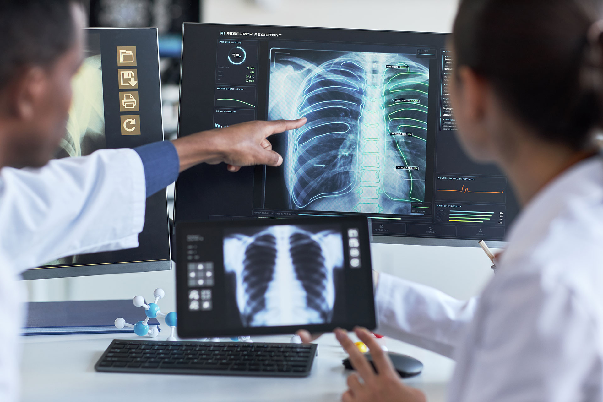 medical-professionals-examining-x-ray-images-in-wo-2026-04-16-18-24-46-utc Médicos radiólogos revisando imágenes de tórax en monitores